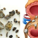Illustration for article titled obat penghancur batu ginjal yang cepat